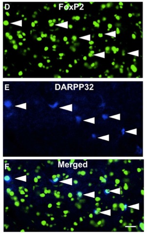 FoxP2 protein in Area X Miller et al., 2008